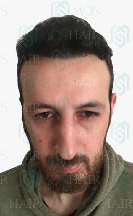 Vaka 6: ekim sonrası