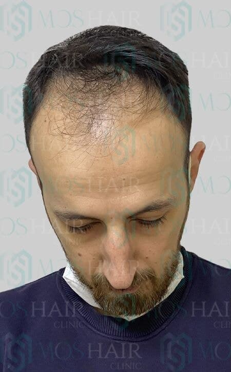 Vaka 6: ekim öncesi