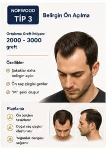 Norwood tipi saç ekimi tip3